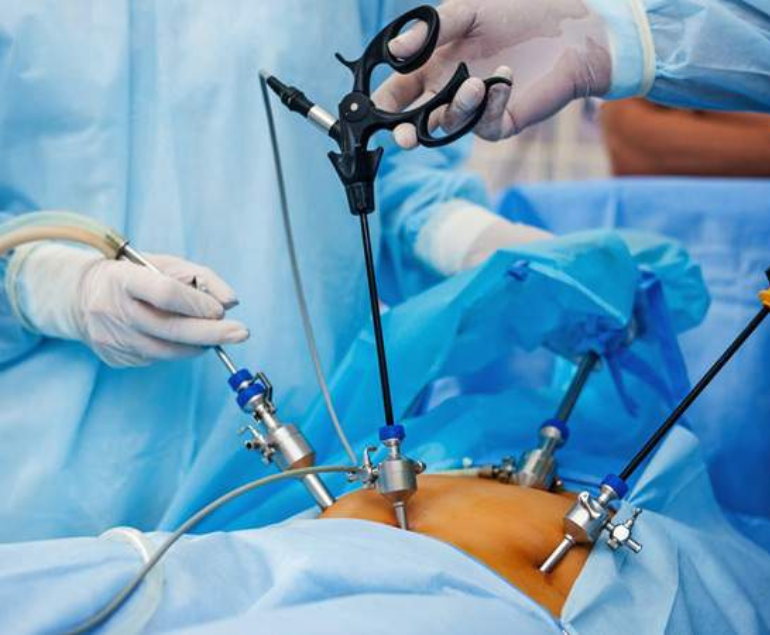 LAPAROSCOPIC UROLOGY